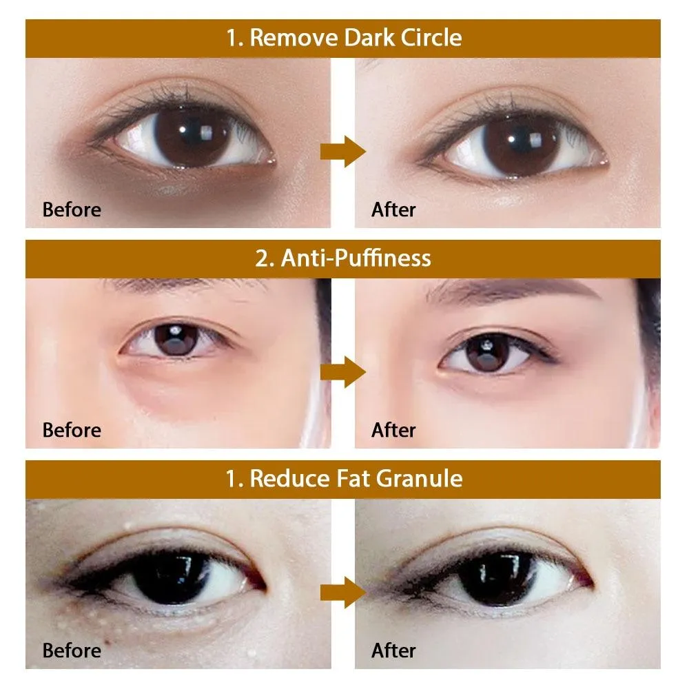 Crystal Collagen Anti Aging Anti Puffiness Dark Circle Reduction  Eye Gel Masks
